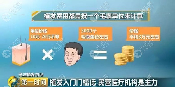 合肥大麦微针植发3000毛囊多少钱