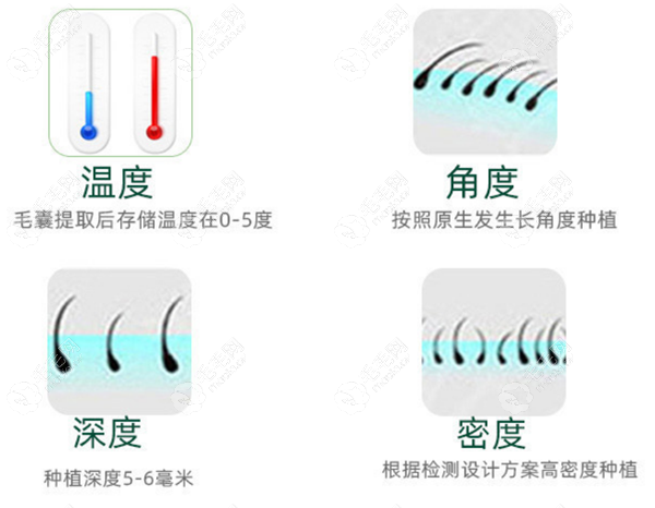 汉中名韩植发优势特点