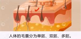 看过3d植发技术手术过程图解后觉得3d植发价格真的不贵