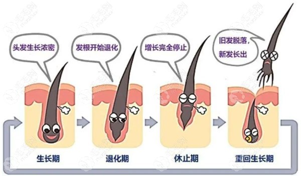 额头宽种植发际线的优缺点