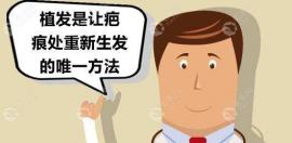 头上疤痕有十几年了能植发吗?头发种植4厘米的疤痕得多少钱