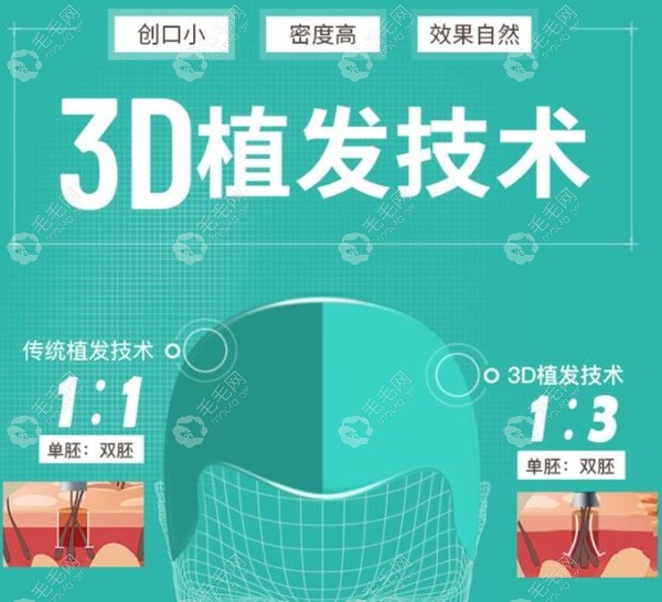 干货!这有武汉新生3D植发技术的价格(包含后续理疗的收费)