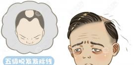 剧透南京大麦微针植发哪个医生比较好!沈晓海和曹志金上榜