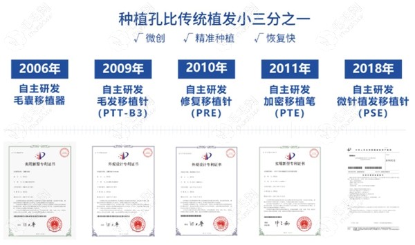 大麦微针植发技术优势