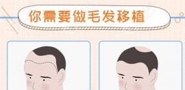 襄阳正规的植发医院哪家好?这些毛发科的植发费用不贵哦