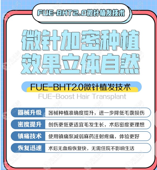 合肥碧莲盛BHT植发技术优势