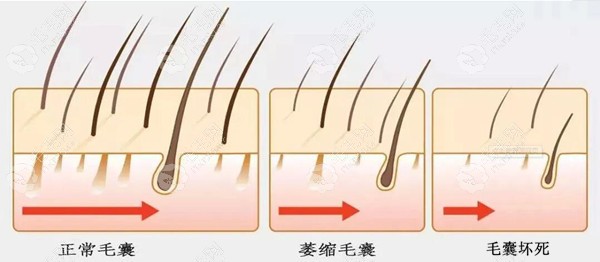 头皮养护可以治疗脱发吗?据说美丝沛能让稀疏头发茂盛哦