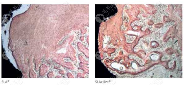 SLAcite表面可以观察到更多的新形血管