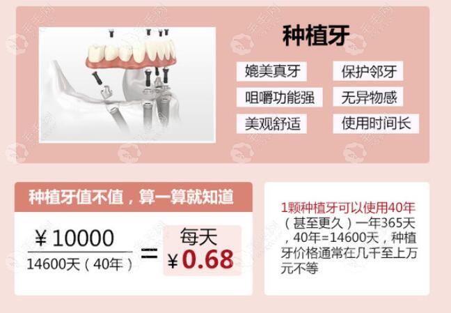 种植牙价格计算