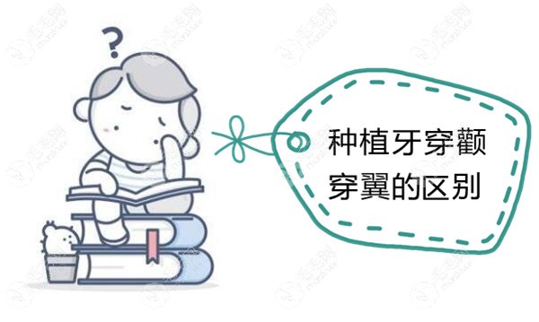 穿颧骨和穿翼板种植牙技术的区别是什么