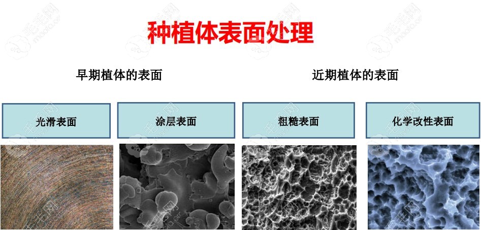 icx种植体表面处理对比