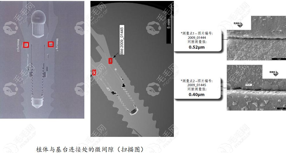 植体和基台连接处微间隙扫描图