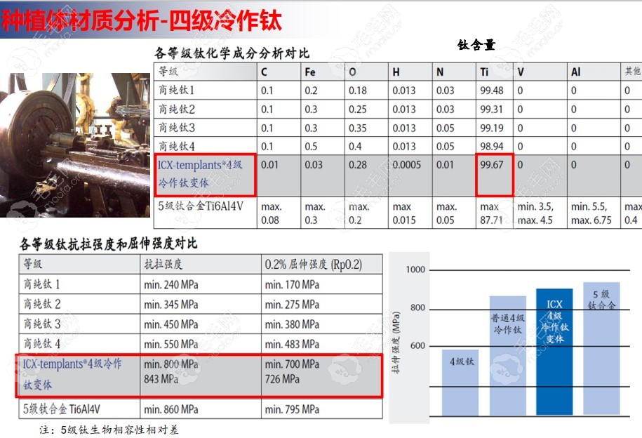 德国种植牙icx牌子好吗？看完icx植体优缺点及寿命解析再说