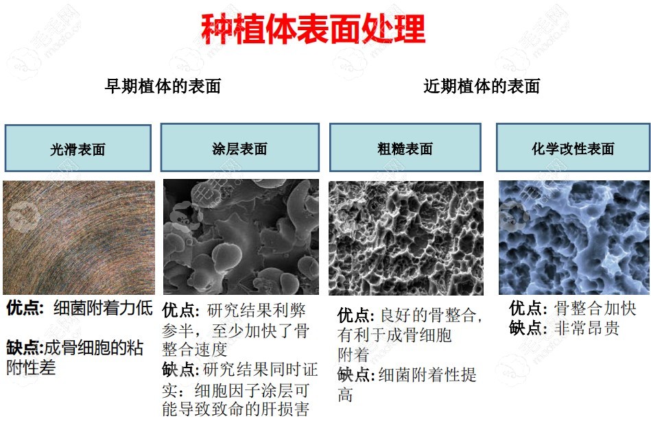 种植牙贵的和便宜的区别在哪?6000块的种植牙比3000的更靠谱?