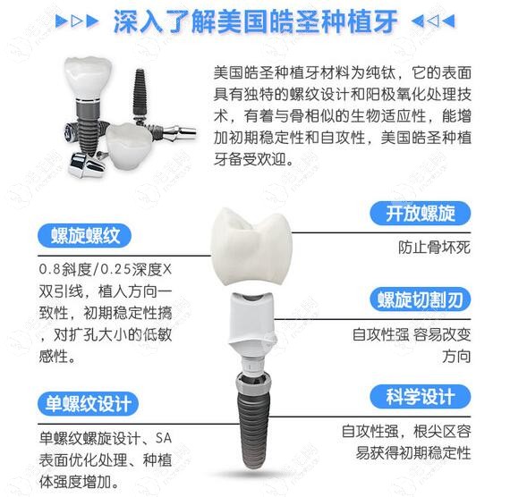 美国皓圣种植牙型号