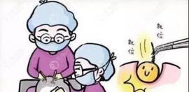 植发手术中精微宝石刀扩孔方法有三种,在3D技术中常用