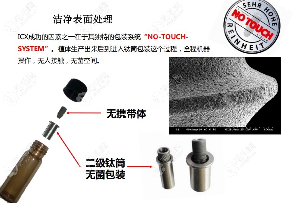 德国种植牙什么牌子好？是icx、bego，还是camlog种植体呢?