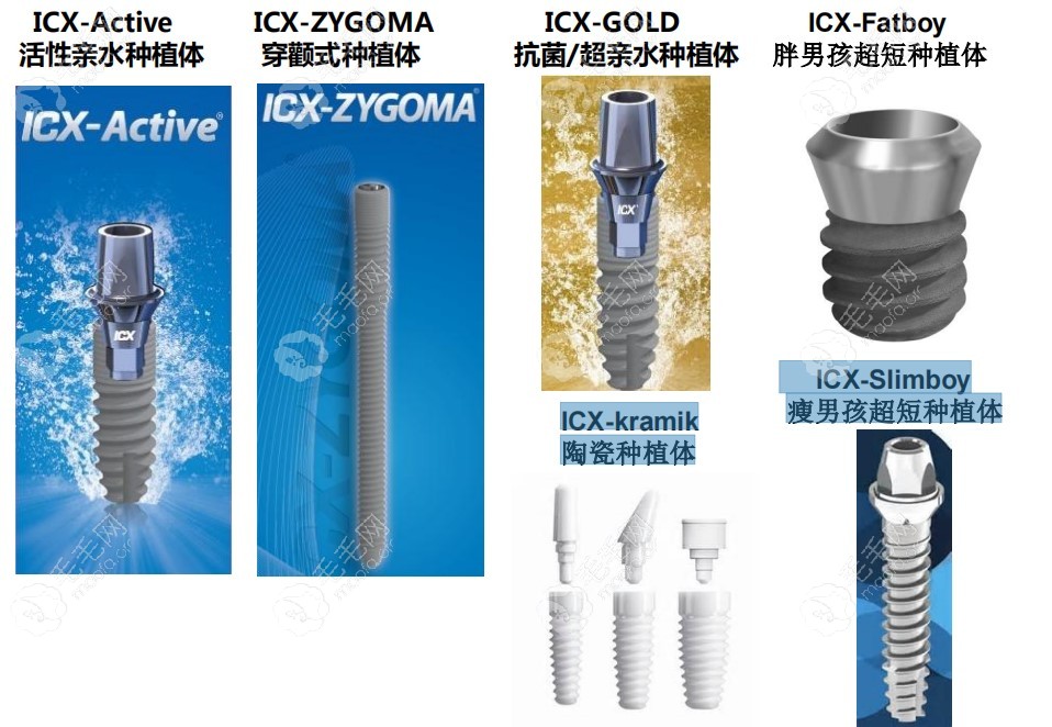 ixc种植体系列型号