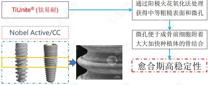 nobel种植体表面处理优势