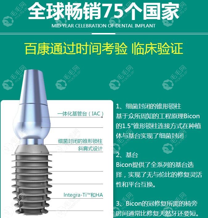 美国百康种植牙的优势点