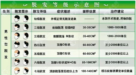 脱发级别及种植数量