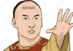 种植发际线后需要注意什么,我那被移植的头发还会长出来吗