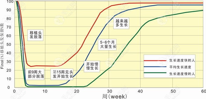 植发后恢复周期图