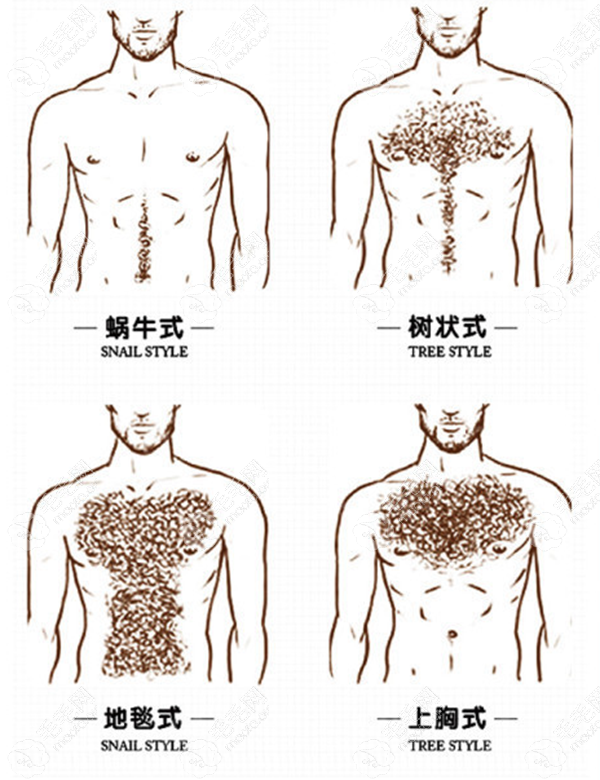 种植胸毛的形状