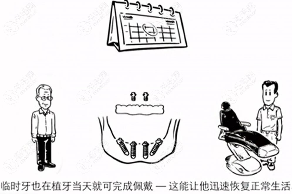 半口即刻负重种植牙戴临牙冠