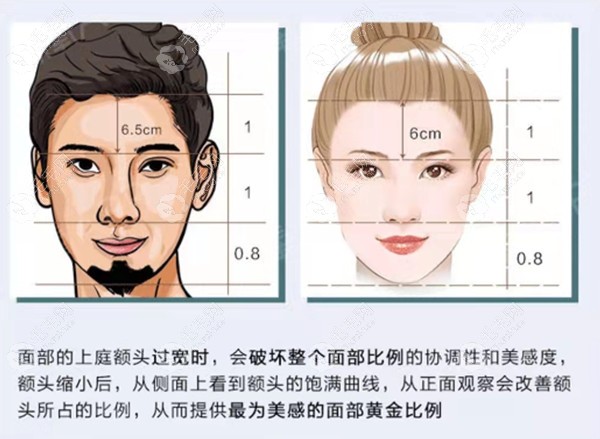 额头高做额头缩小手术还是植发际线都行,其区别不止于价格