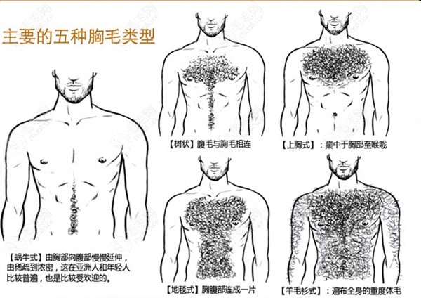 胸毛种植大概多少钱,男性胸毛种植形状和方向决定它的价格