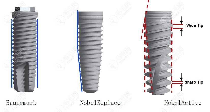 瑞典nobel active种植牙怎么样?据说能和iti瑞锆亲水种植体媲美