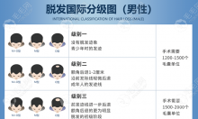 预知头发秃顶到遵义植发需要多少钱,需先知植发多少1个单位