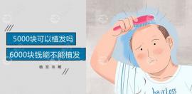 花3000/5000/6000块钱能不能植发,如果可以能植发多少?