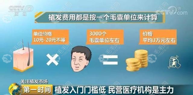 青海西宁植发3000毛囊单位需要多少钱?找城东/城中植发医院