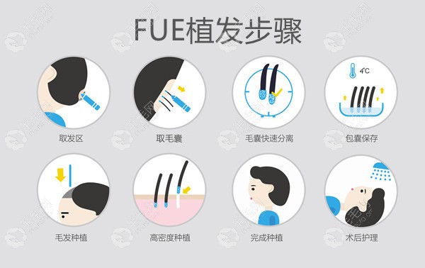 FUE植发技术的手术过程