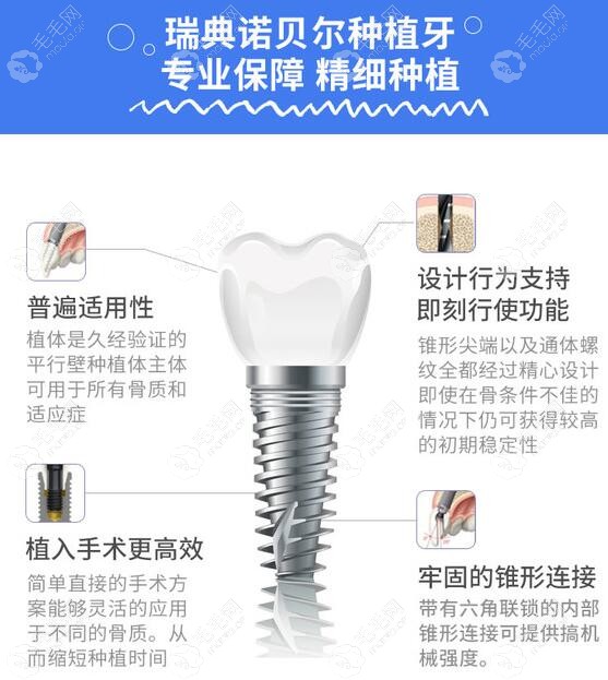 瑞典诺贝尔pmc种植体的价格为什么便宜，听说才8000多一颗