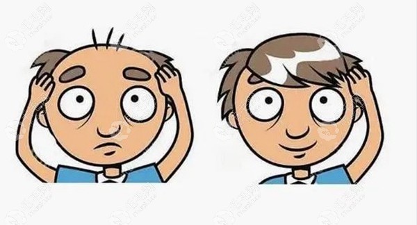 有发际线还是挺好看的嘛