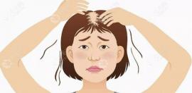女生頭頂頭發(fā)稀疏可以植發(fā),這有女性頭頂加密植發(fā)圖片參考