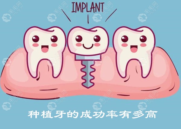 种植牙的成功率有多高?如果种植牙失败了该怎么处理