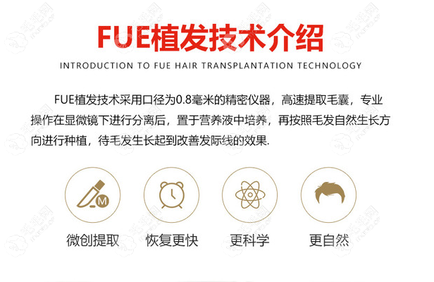 fue植发技术的特点