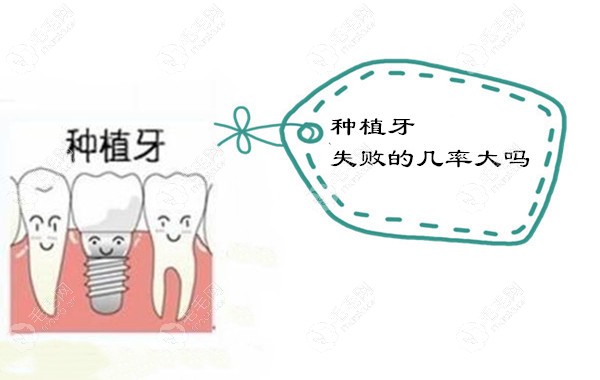 种植牙的失败几率大吗