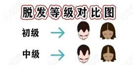 7級(jí)脫發(fā)植發(fā)要多少個(gè)毛囊單位?若3000不夠那5000單位呢(含圖)