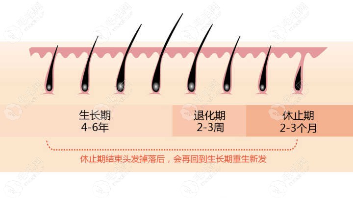 植发后的脱落期也不担心