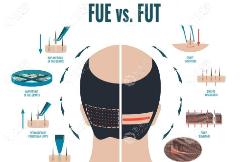 fue与传统fut之间的区别