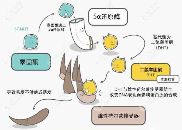 脱发原因主要是 DHT 在作祟