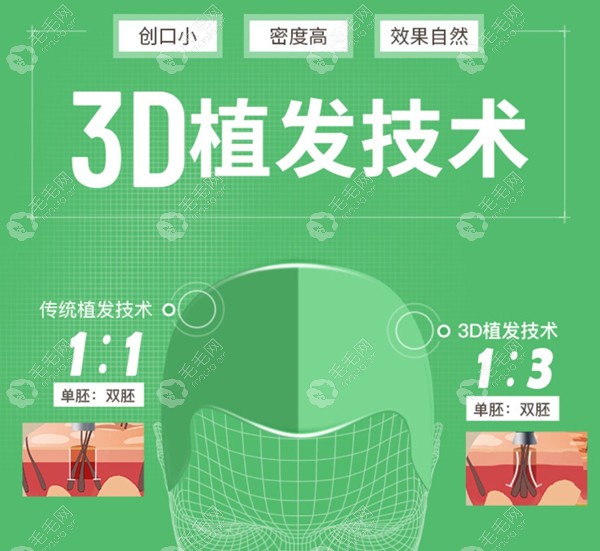 3d植发技术能够提取更多的多胚毛囊，适合毛囊资源不足的发友