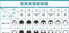 在洛阳正规的毛发专科医院做男士植发5000个单位得多少钱