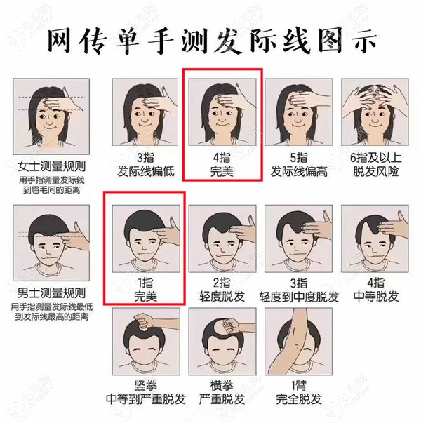 手指测量发际线