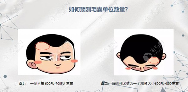 预测毛囊的单位数量的判别方式